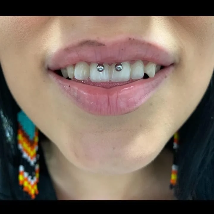 Smiley — oral piercing